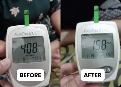 before after Rosmiati