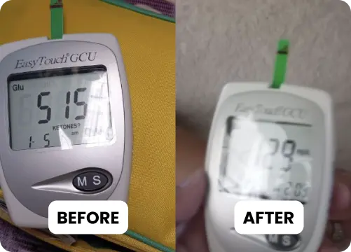 before after Diah