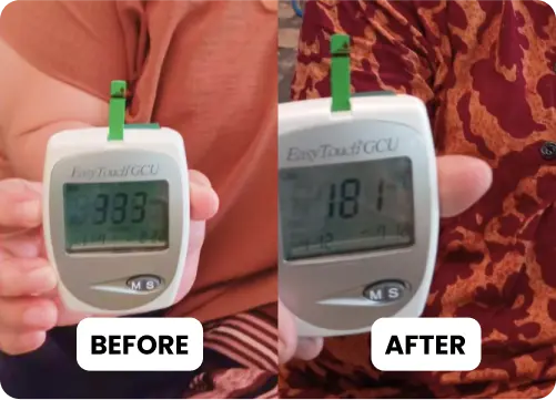 before after Kasni